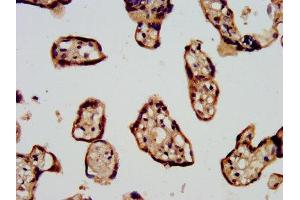 IHC image of ABIN7169072 diluted at 1:500 and staining in paraffin-embedded human placenta tissue performed on a Leica BondTM system. (CDC42BPB antibody  (AA 1609-1711))
