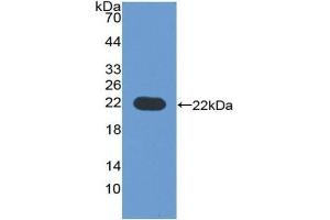Detection of Recombinant CYP3A4, Human using Polyclonal Antibody to Cytochrome P450 3A4 (CYP3A4) (CYP3A4 antibody  (AA 344-497))