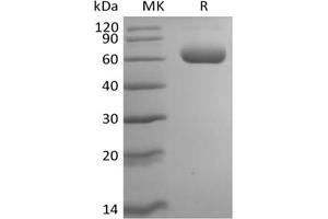 Sialic Acid Binding Ig-Like Lectin 5 (SIGLEC5) protein (His tag)