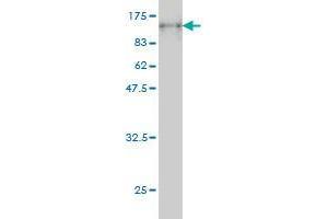 Western Blot detection against Immunogen (111. (PCDHB16 antibody  (AA 1-776))