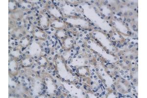 Formalin-fixed and paraffin embedded mouse kidney cells labeled with Rabbit Anti-CD4 Polyclonal Antibody, Unconjugated (ABIN672936) 1:200 followed by conjugation to the secondary antibody and DAB staining. (CD4 antibody  (AA 231-330))