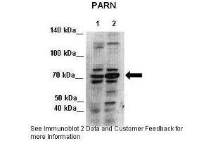 Lanes:   Lane 1: 7ug HEK293 cytoplasmic lysate  2: 7ug HEK293 nuclei lysate  Primary Antibody Dilution:   1:500  Secondary Antibody:   Anti-rabbit-HRP  Secondary Antibody Dilution:   1:500  Gene Name:   PARN  Submitted by:   Seiji Masuda, Kitashirakawa Oiwakecho, Kyoto University (PARN antibody  (N-Term))