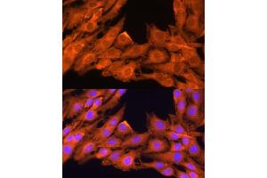 Immunofluorescence analysis of C6 cells using PRKCB antibody (ABIN6128463, ABIN6146200, ABIN6146202 and ABIN6221544) at dilution of 1:100. (PKC beta antibody  (AA 220-340))