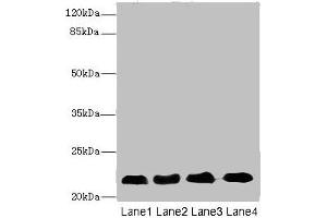Western blot All lanes: CRIP2 antibody at 5. (CRIP2 antibody  (AA 1-208))