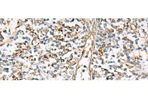 Immunohistochemistry of paraffin-embedded Human tonsil tissue using NPC2 Polyclonal Antibody at dilution of 1:80(x200) (NPC2 antibody)