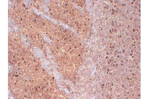 KvBeta 1. (KCNAB1 antibody  (N-Term))
