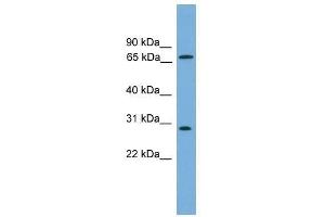 Western Blot showing SEMG2 antibody used at a concentration of 1-2 ug/ml to detect its target protein. (SEMG2 antibody  (N-Term))