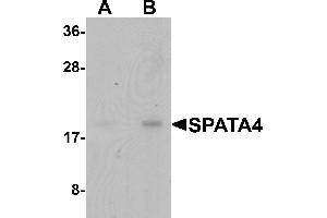 Western Blotting (WB) image for anti-Spermatogenesis Associated Protein 4 (SPATA4) (C-Term) antibody (ABIN1077367) (SPATA4 antibody  (C-Term))