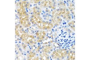 Immunohistochemistry of paraffin-embedded mouse kidney using SCO1 antibody. (SCO1 antibody  (AA 1-160))