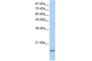 WB Suggested Anti-ID3 Antibody Titration:  1. (ID3 antibody  (N-Term))