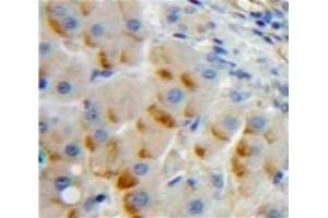 IHC-P analysis of Liver tissue, with DAB staining. (TLR8 antibody  (AA 844-1039))