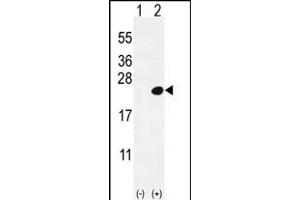 Western blot analysis of DOK5 (arrow) using rabbit polyclonal DOK5 Antibody  (ABIN392075 and ABIN2841837). (DOK5 antibody  (C-Term))