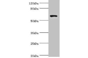 Western blot All lanes: Glutamate decarboxylase 1 antibody at 8 μg/mL + HepG2 whole cell lysate Secondary Goat polyclonal to rabbit IgG at 1/10000 dilution Predicted band size: 67, 26, 48 kDa Observed band size: 67 kDa (GAD antibody  (AA 1-200))