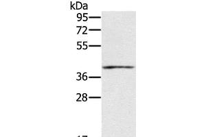 Western Blot analysis of Mouse muscle tissue using IFNGR2 Polyclonal Antibody at dilution of 1:200