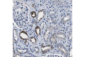 ABIN6266549 at 1/100 staining human kidney tissue sections by IHC-P. (GRIK1 antibody  (Internal Region))