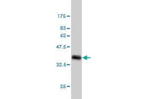 Western Blotting (WB) image for anti-Mediator Complex Subunit 1 (MED1) (AA 1391-1490) antibody (ABIN562335)