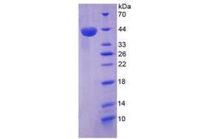 Image no. 1 for Chemokine (C-X-C Motif) Ligand 12 (CXCL12) (AA 23-89) (Active) protein (His tag,GST tag) (ABIN6239854) (CXCL12 Protein (AA 23-89) (His tag,GST tag))