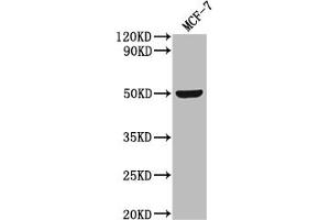 Western Blot Positive WB detected in: MCF-7 whole cell lysate All lanes: SLC52A3 antibody at 1:2000 Secondary Goat polyclonal to rabbit IgG at 1/50000 dilution Predicted band size: 51, 46 kDa Observed band size: 51 kDa (Solute Carrier Family 52 (Riboflavin Transporter), Member 3 (SLC52A3) (AA 159-220) antibody)