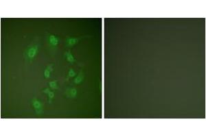 Immunofluorescence analysis of HepG2 cells, using Smad2 (Ab-467) Antibody. (SMAD2 antibody  (AA 418-467))