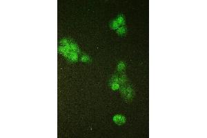 anti-SMC6 Structural Maintenance of Chromosomes 6-Like 1 (SMC6) (AA 205-443) antibody