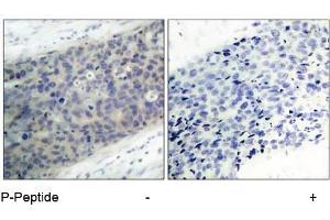 Image no. 3 for anti-LIM Domain Kinase 2 (LIMK2) (pThr505) antibody (ABIN196832) (LIMK2 antibody  (pThr505))