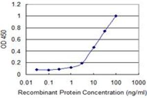 Detection limit for recombinant GST tagged ULK2 is 0. (ULK2 antibody  (AA 743-843))