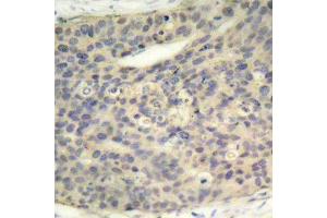 Immunohistochemistry (IHC) image for anti-LIM Domain Kinase 1 (LIMK1) (pThr508) antibody (ABIN1681739) (LIM Domain Kinase 1 antibody  (pThr508))