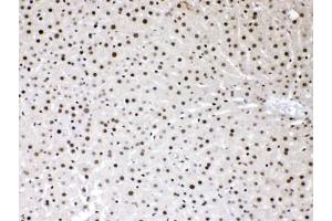Immunohistochemistry (IHC) image for anti-High Mobility Group Box 1 (HMGB1) (AA 124-154) antibody (ABIN5647575)