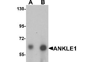 Western blot analysis of ANKLE1 in 293 cell lysate with ANKLE1 antibody at (A) 1 and (B) 2 µg/mL. (ANKLE1 antibody  (C-Term))