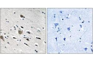 Immunohistochemistry analysis of paraffin-embedded human brain tissue, using MRPL52 Antibody. (MRPL52 antibody  (AA 71-120))