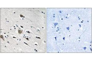 Immunohistochemistry analysis of paraffin-embedded human brain tissue, using MRPL52 Antibody. (MRPL52 antibody  (AA 71-120))