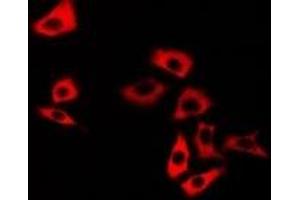 Immunofluorescent analysis of Calsarcin 1 staining in U2OS cells. (MYOZ2 antibody)