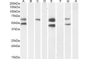 (ABIN570984) (1 μg/mL) staining of Human Cerebral Cortex (A) + peptide (B), (0. (CaMKII alpha/beta (Internal Region) antibody)