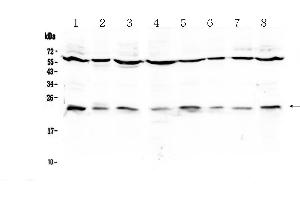 Western blot analysis of IL1RA using anti-IL1RA antibody . (IL1RN antibody  (AA 26-177))