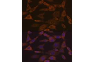 Immunofluorescence analysis of NIH-3T3 cells using Ephrin  Rabbit mAb (ABIN7266976) at dilution of 1:100 (40x lens). (Ephrin A1 antibody)