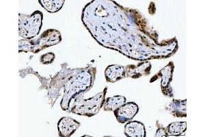 IHC analysis of CSNK2K2 using anti-CSNK2K2 antibody (ABIN7602871). (CSNK2A2 antibody  (C-Term))