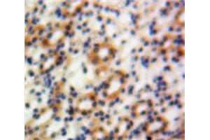 Used in DAB staining on fromalin fixed paraffin-embedded Kidney tissue (Granulin antibody  (AA 361-585))