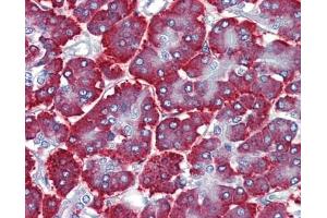 FEZF1 antibody was used for immunohistochemistry at a concentration of 4-8 ug/ml. (FEZF1 antibody  (C-Term))