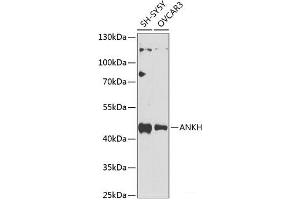 Western blot analysis of extracts of various cell lines using ANKH Polyclonal Antibody at dilution of 1:1000.