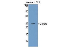 Western Blotting (WB) image for anti-Complement Component 1, Q Subcomponent Binding Protein (C1QBP) (AA 76-282) antibody (ABIN1078149) (C1QBP antibody  (AA 76-282))