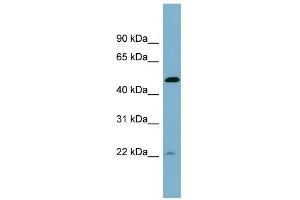 WB Suggested Anti-UCHL5IP Antibody Titration: 0. (HAUS7 antibody  (Middle Region))