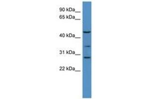 B3GALT2 antibody  (AA 352-401)