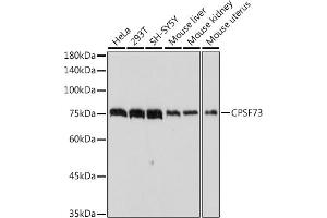 Western blot analysis of extracts of various cell lines, using CPSF73 antibody (ABIN3015868, ABIN3015869, ABIN1679207, ABIN1679208 and ABIN7101452) at 1:1000 dilution. (CPSF3 antibody)