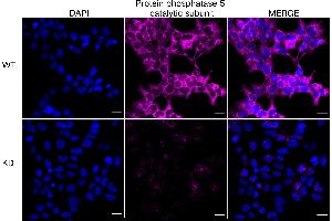 anti-Protein Phosphatase 5, Catalytic Subunit (PPP5C) antibody