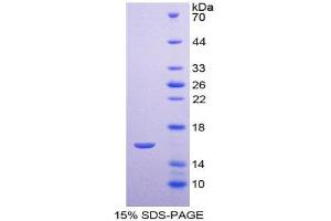 SDS-PAGE (SDS) image for Annexin A3 (ANXA3) (AA 190-312) protein (His tag) (ABIN1169889)