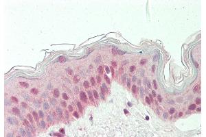 Rabbit Anti-RARG antibody  Formalin Fixed Paraffin Embedded Tissue: Human Skin Primary antibody Concentration: 1:100 Secondary Antibody: Donkey anti-Rabbit-Cy3 Secondary Antibody Concentration: 1:200 Magnification: 20x Exposure Time: 0. (Retinoic Acid Receptor gamma antibody  (N-Term))