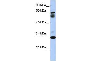 WB Suggested Anti-TMEM187  Antibody Titration: 0. (TMEM187 antibody  (Middle Region))