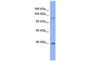 WB Suggested Anti-ZNF827 Antibody Titration:  0.
