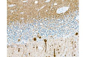 Immunohistochemistry (IHC) image for anti-Tubulin, beta 3 (TUBB3) (AA 400-450) antibody (ABIN7453957) (Recombinant TUBB3 antibody  (AA 400-450))