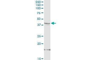 Western Blotting (WB) image for anti-Hydroxy-delta-5-Steroid Dehydrogenase, 3 beta- and Steroid delta-Isomerase 1 (HSD3B1) (AA 1-373) antibody (ABIN516698)